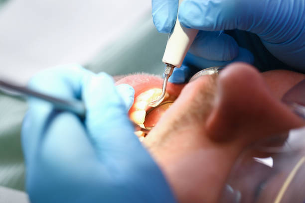 Best After-Hours Dental Trauma Care in Wink, TX