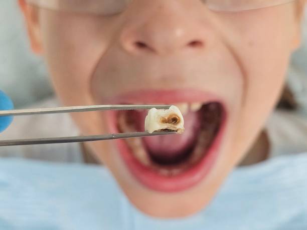 Best Emergency Gum Treatment in Wink, TX